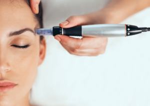 Dermapen bei Dr. Scarlett Lewitschnig -  - Foto:© Freepik